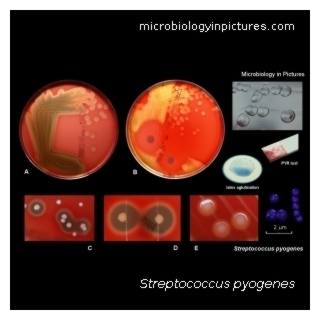 s.pyogenes